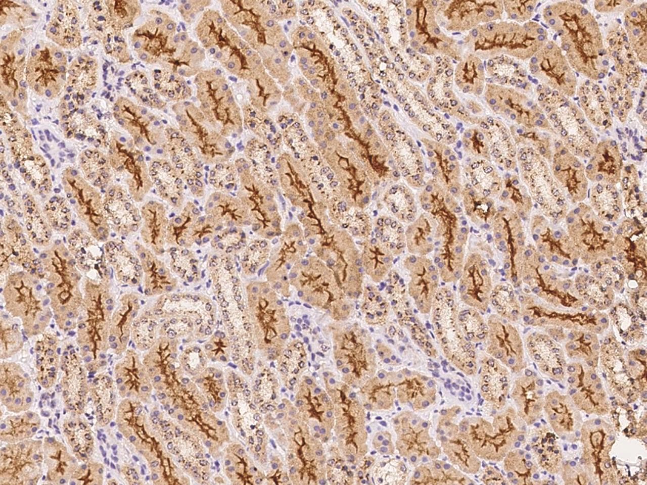 GALNT18 / GALNTL4 Antibody