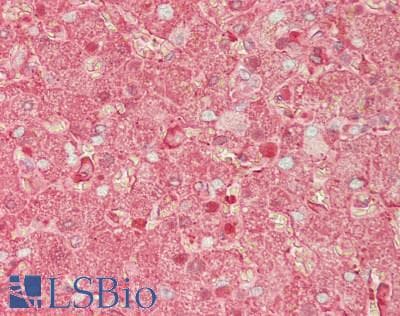 IHC-plus™ HP / Haptoglobin Antibody (aa 19-406)
