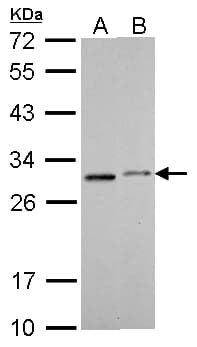SDHB Antibody (aa221-280)