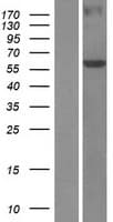 TBRG4 Protein (Over-Expression Lysate Myc-DDK (Flag))