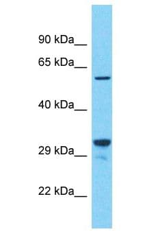 CYBB / NOX2 / gp91phox Antibody (aa512-561)