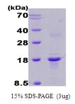 Human RCAN1 / DSCR1 Protein (Recombinant)