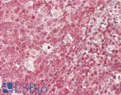 IHC-plus™ WHSC1 / NSD2 Antibody