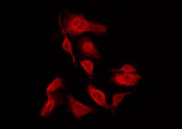 HSPB1 / HSP27 Antibody (phospho-Ser15)