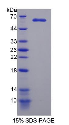 Human MAST205 / MAST2 Protein (Recombinant His-S)