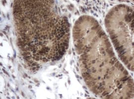 ZIM2 Antibody (clone OTI6D12)