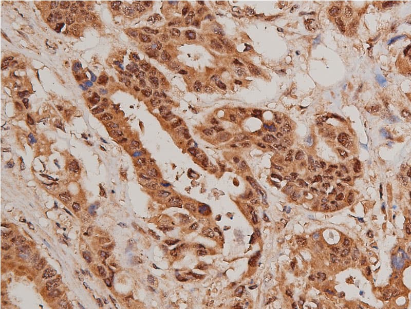 FOXO1 / FKHR Antibody (phospho-Ser319)