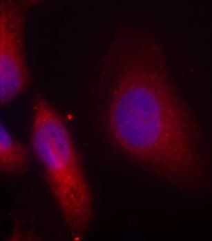 SRC Antibody (phospho-Tyr529)