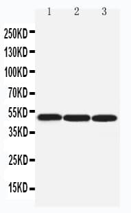 Polyclonal Rabbit anti-Human ARRB1 / Beta Arrestin 1 Antibody (aa82-103, IHC, WB)