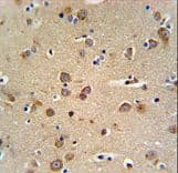 GABRG3 Antibody (aa1-29)