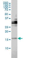 Monoclonal Mouse anti-Human TRAPPC2 / SEDL Antibody (clone 2E10, WB)