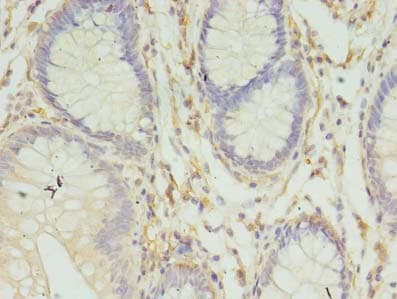 IHC-plus™ Polyclonal Rabbit anti-Human HLA-DRB4 Antibody (IHC, WB)