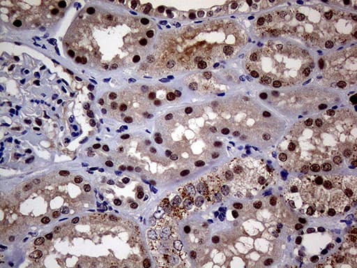 Monoclonal Mouse anti-Human UPRT Antibody (clone OTI1D12, IHC, WB)