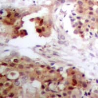 Polyclonal Rabbit anti-Human APOBEC3G / CEM15 Antibody (IHC, IF, WB)
