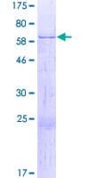 Human GRAB / RAB3IL1 Protein (Recombinant GST)