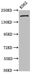 PSME4 / PA200 Antibody