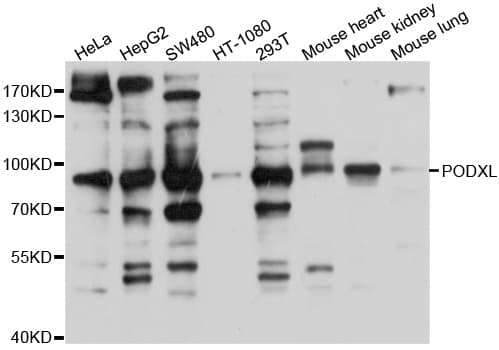 PODXL / Podocalyxin Antibody