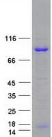 Human ADAR2 / ADARB1 Protein (Recombinant Myc-DDK (Flag))