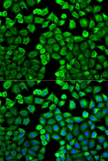 HMT / HNMT Antibody