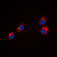 Polyclonal Rabbit anti-Human SEMA4A / Semaphorin 4A Antibody (Internal, IF, WB)