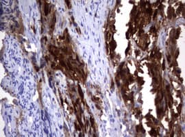 Monoclonal Mouse anti-Human TS / Thymidylate Synthase Antibody (clone OTI1B1, IHC, WB)