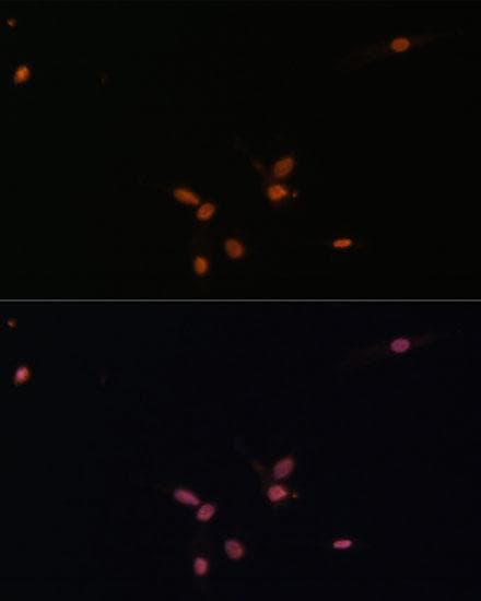 SMAD7 Antibody