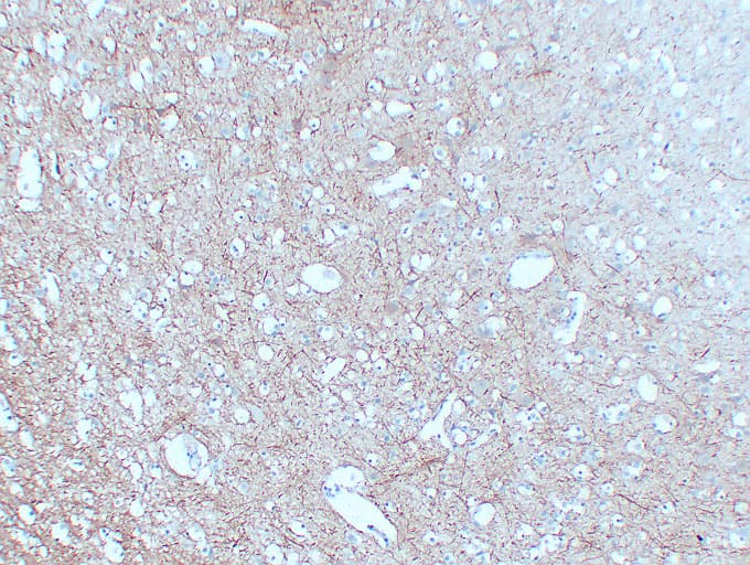 NF-L / NEFL Antibody (clone ABT-NF)