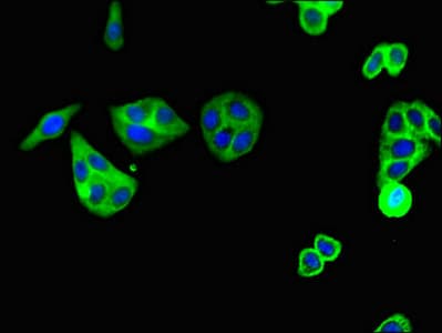 C5AR1 / CD88 / C5a Receptor Antibody