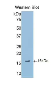 TGFB4 / LEFTY2 Antibody (aa245-356, FITC)