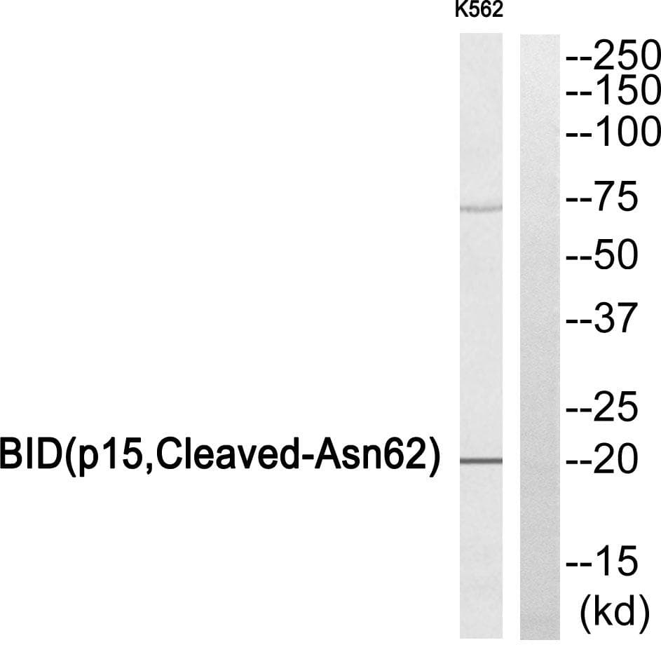 Polyclonal Rabbit anti-Human BID Antibody (p15, Cleaved-Asn62, WB)