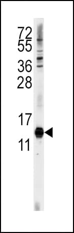 CDA / Cytidine Deaminase Antibody (aa118-146)