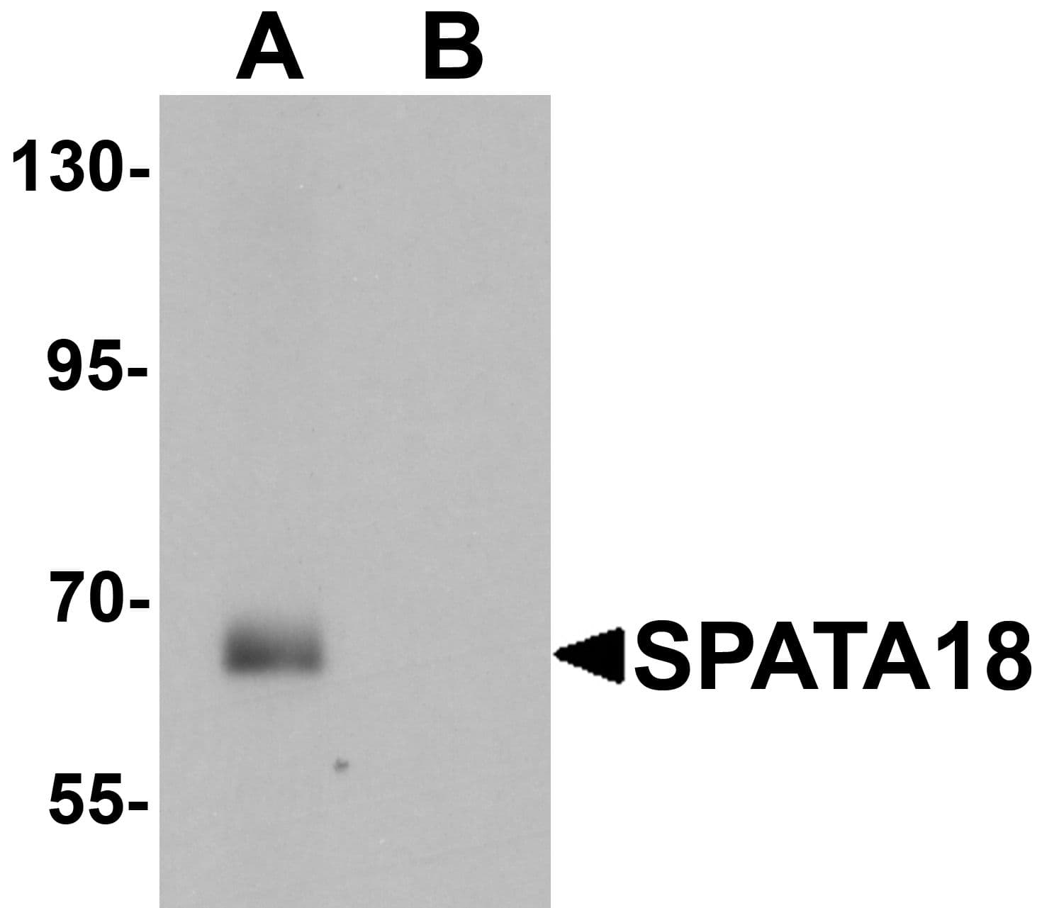 IHC-plus™ SPATA18 / MIEAP Antibody