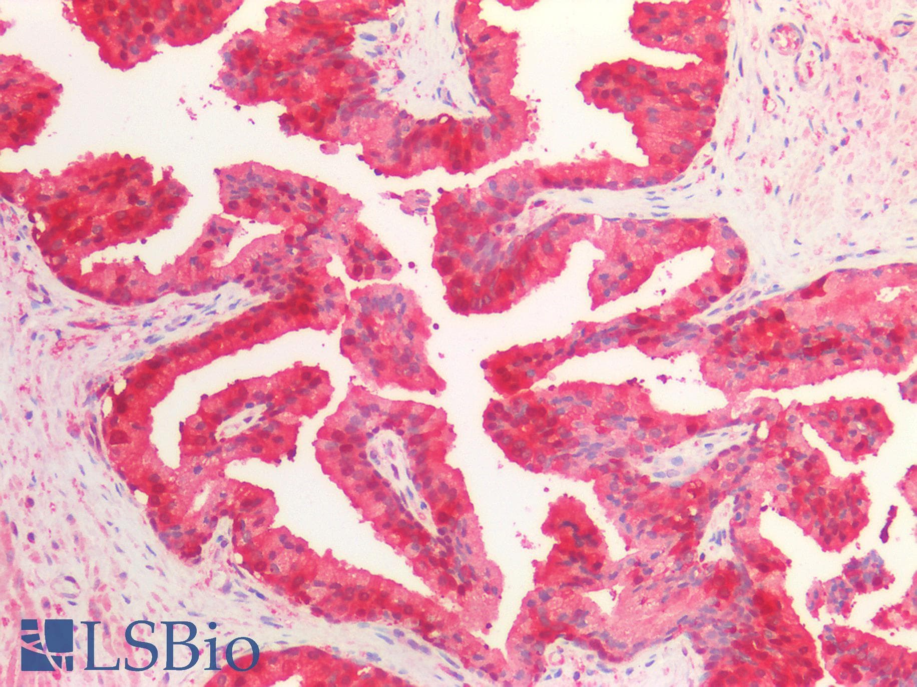 IHC-plus™ PRDX6 / Peroxiredoxin 6 Antibody (aa15-27)