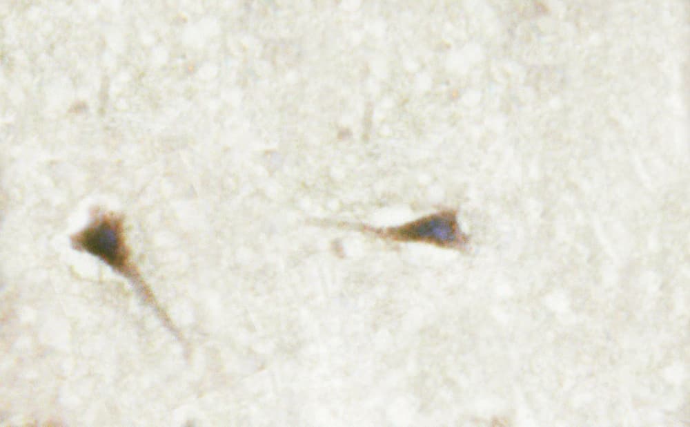 CML / BCR Antibody (phospho-Tyr360)