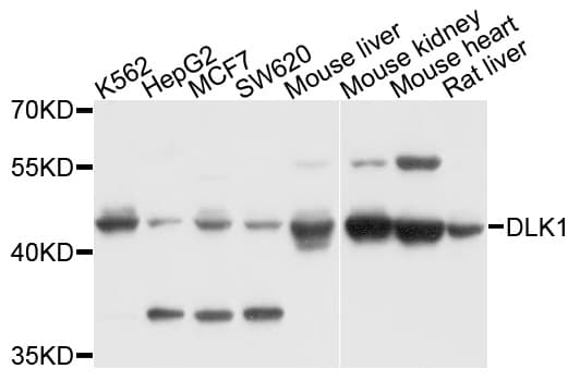 Polyclonal Rabbit anti-Human DLK1 / Pref-1 Antibody (IHC, WB)
