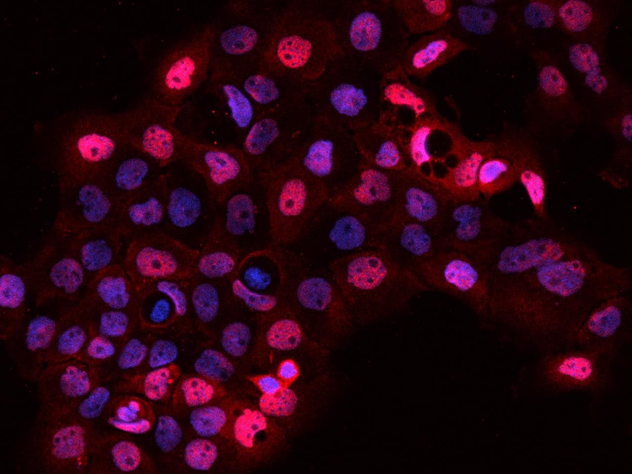 SARNP / Hcc-1 / CIP29 Antibody
