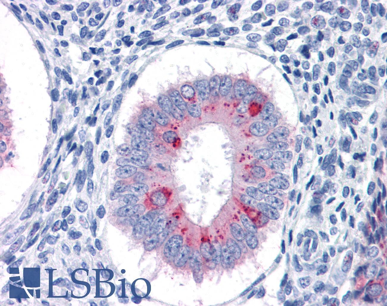 PathPlus™ Monoclonal Mouse anti-Human TFF3 / Trefoil Factor 3 Antibody (clone 3D9, IHC, WB)