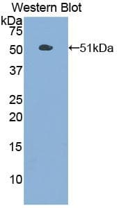 PKM / Pyruvate Kinase, Muscle Antibody (aa294-470, Biotin)