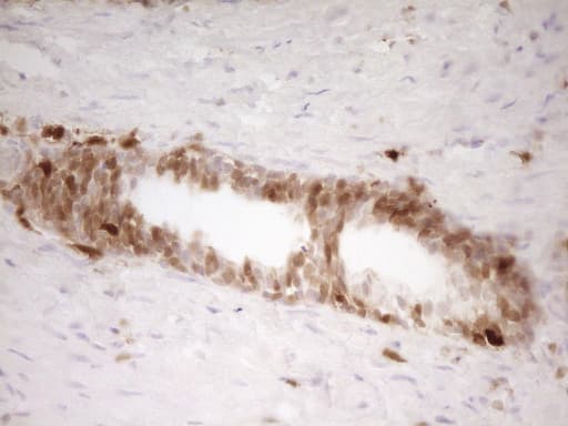 IHC-plus™ LGALS9 / Galectin 9 Antibody (clone 2A4)