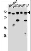 ASMTL Antibody (aa231-259)