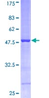 Human PPIB / Cyclophilin B Protein (Recombinant GST)