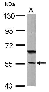 Polyclonal Rabbit anti-Human DNAJC7 Antibody (aa151-473, IHC, WB)