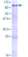 Human SNCAIP / Synphilin 1 Protein (Recombinant GST)