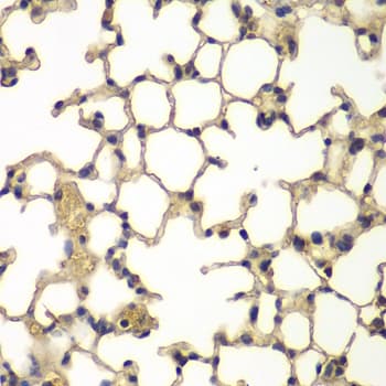 IFRD1 / TIS7 Antibody