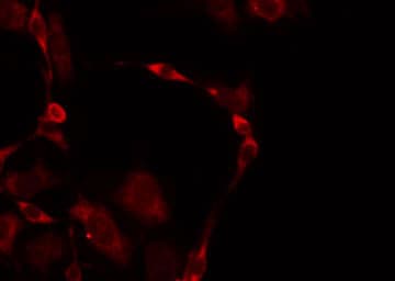 ZDHHC7 Antibody