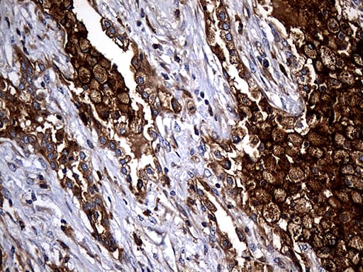 Monoclonal Mouse anti-Human CPM / Carboxypeptidase M Antibody (clone OTI4E11, aa124-423, IHC, WB)