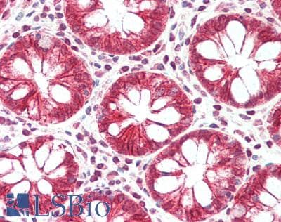 IHC-plus™ TIAL1 Antibody (aa325-375)