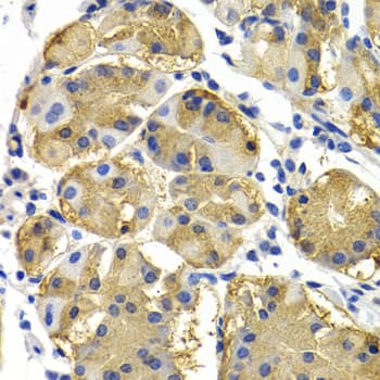 Polyclonal Rabbit anti-Human PTEN Antibody (IHC, WB)