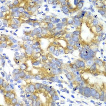MtTFA / TFAM Antibody