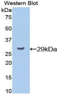 CCND1 / Cyclin D1 Antibody (aa31-295)